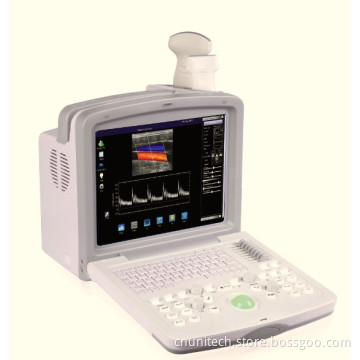 Portable Color Doppler (UNT-6000)